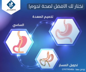 افضل طبيب جراحة السمنة في عمان