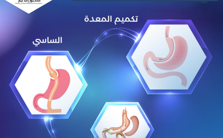 افضل طبيب جراحة السمنة في عمان